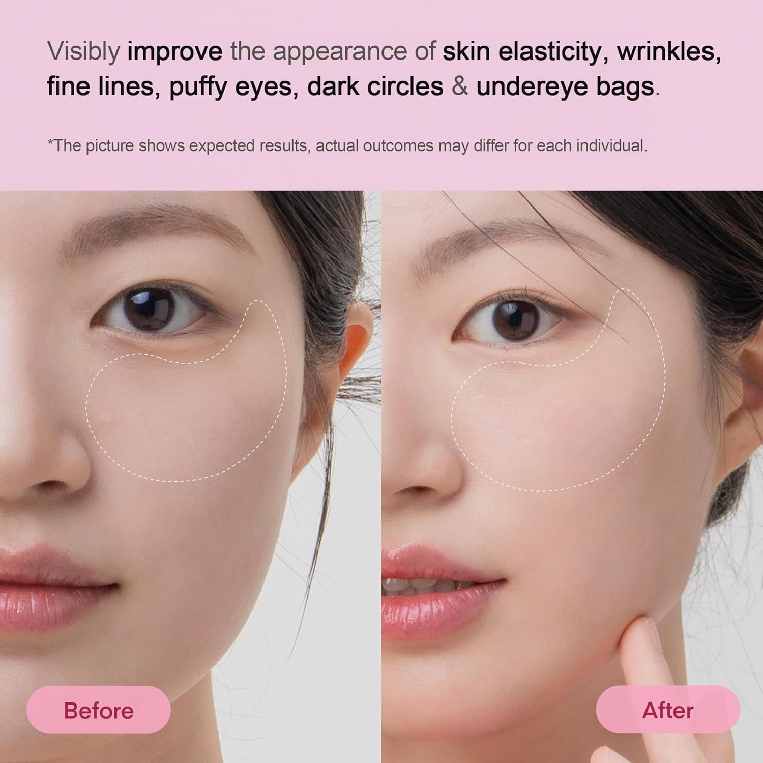 TEREZ & HONOR Peptide Collagen Under Eye Patches - 60 Korean Firming, Glowing & Hydrating Hydrogel Mask for Puffy Eyes, Dark Circles, Wrinkles, Fine Lines, Undereye Bags - Anti-Aging Eye Gel Pads - Image 4